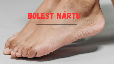 Bolest nártu: Varovný signál nohy, který není radno přehlížet! | ARNO.cz - obuv s tradicí